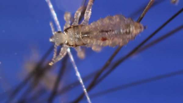 Head Lice Pediculus Humanus Capitis About 3 Mm In Length