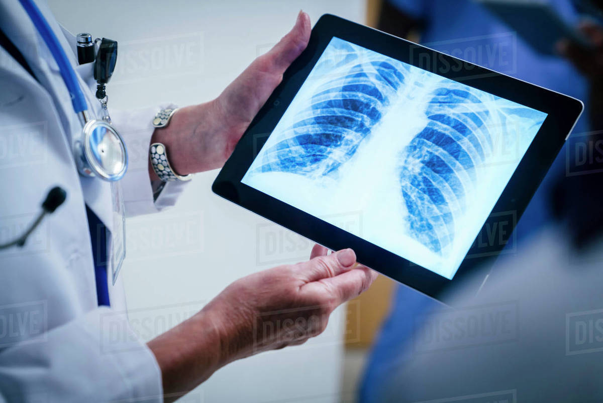 Doctors examining xray of chest and ribs on digital tablet Stock