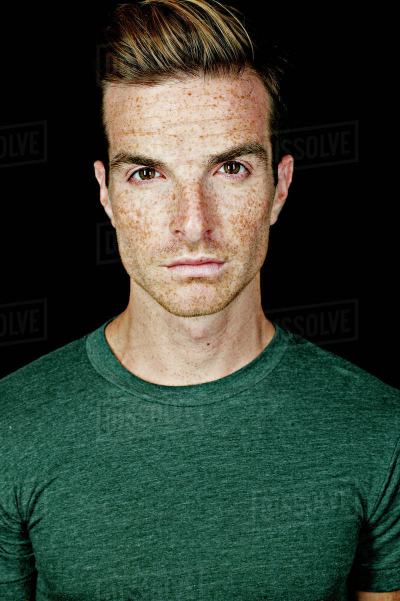 Serious Caucasian man with freckles Stock Photo Dissolve