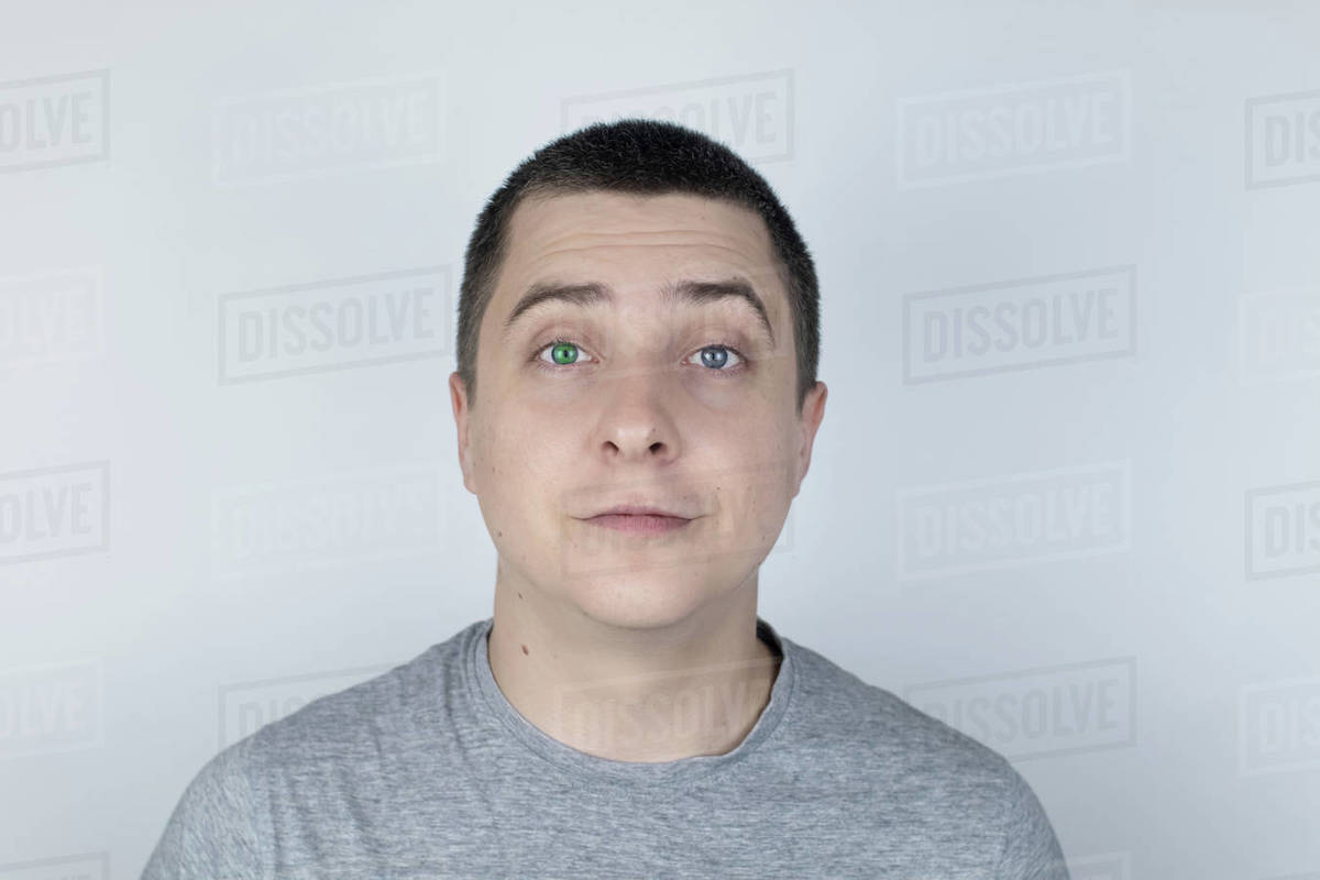 A man with different color eyes looks into the frame. The right eye is