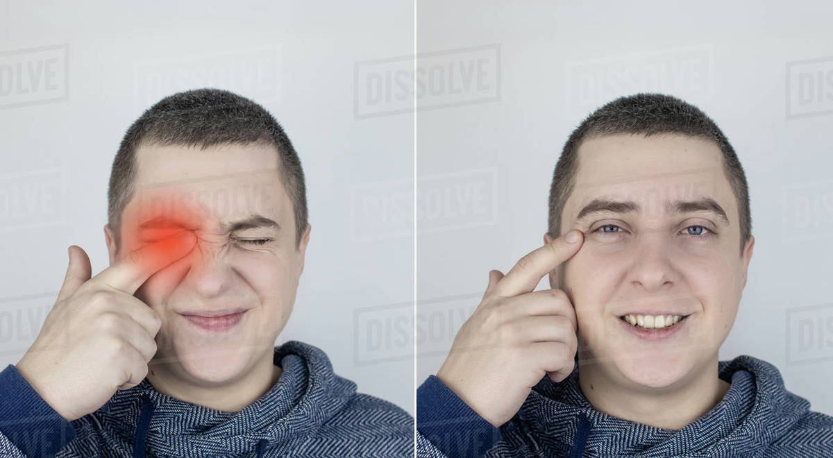 Before and after. On the left the man indicates eyes pain, and on the