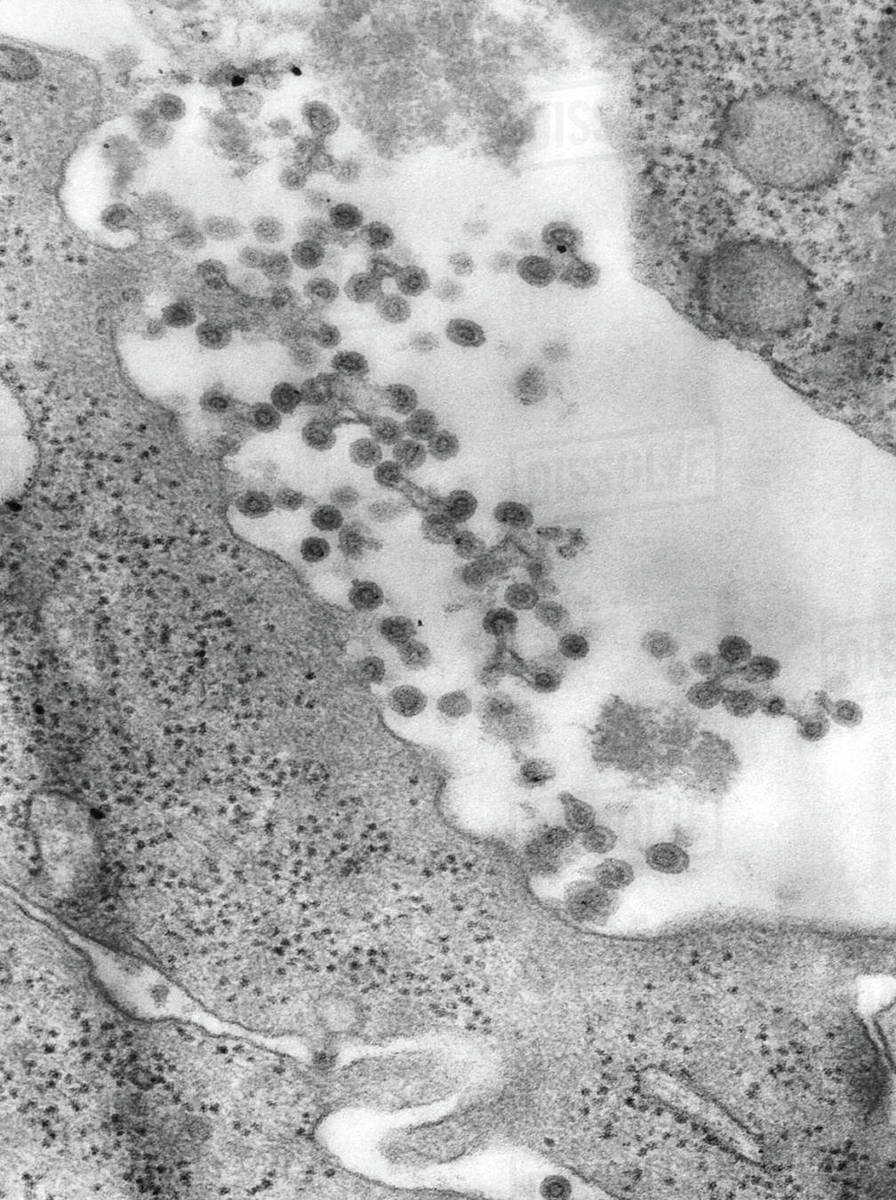 Negativelystained transmission electron micrograph of Rubella virus